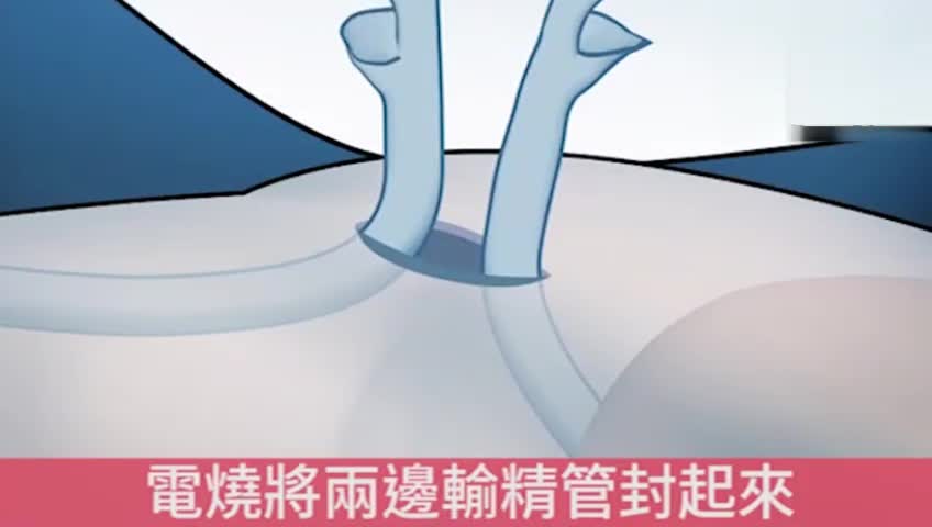 熱點(diǎn) 第185頁