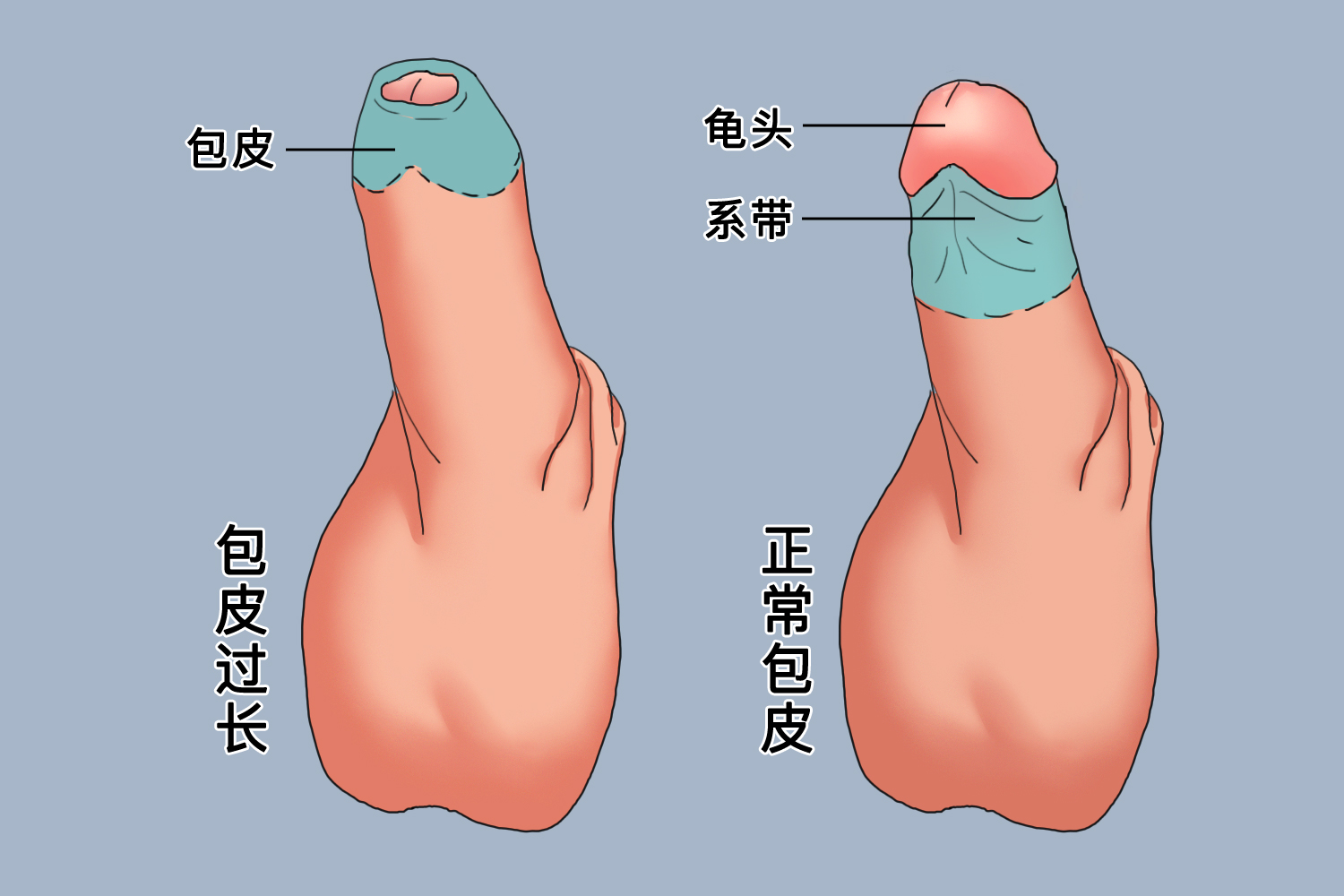 探索男性生理奧秘，包皮的正常形態(tài)解析，男性生理奧秘探索，包皮正常形態(tài)解析