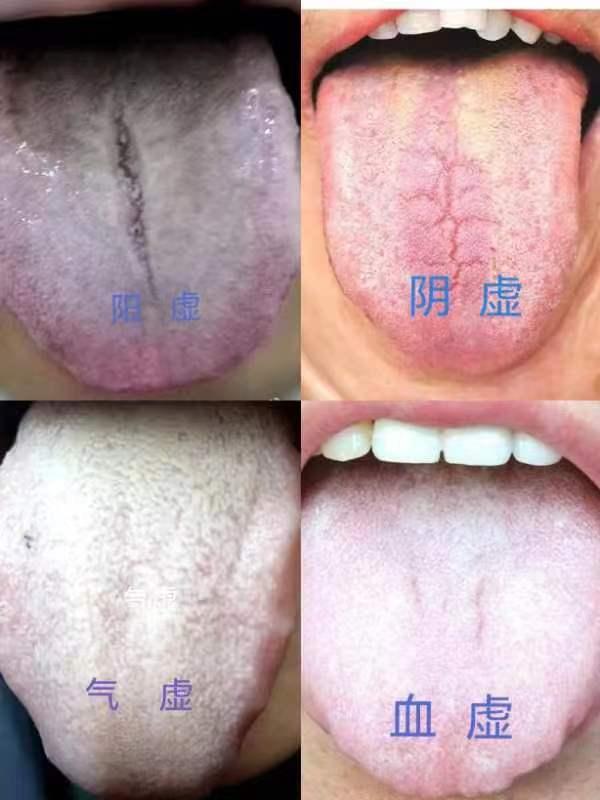 男性腎陽虛的癥狀及其影響，男性腎陽虛癥狀與影響概述