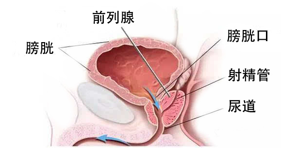 普樂(lè)安片治療前列腺炎的療程與效果，深度解析，普樂(lè)安片治療前列腺炎療程與效果深度解析，療程長(zhǎng)短與治療效果一覽無(wú)余。